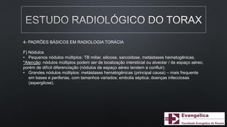 4- PADRÕES BÁSICOS EM RADIOLOGIA TORÁCIA
F) Nódulos
• Pequenos nódulos múltiplos: TB miliar, silicose, sarcoidose, metástases hematogênicas.
*Atenção: nódulos múltiplos podem ser de localização intersticial ou alveolar / de espaço aéreo,
porém de difícil diferenciação (nódulos de espaço aéreo tendem a confluir).
• Grandes nódulos múltiplos: metástases hematogênicas (principal causa) – mais frequente
em bases e periferias, com tamanhos variados; embolia séptica; doenças infecciosas
(aspergilose).
 