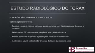 4- PADRÕES BÁSICOS EM RADIOLOGIA TORÁCIA
G) Escavações (cavitações):
• Cavidade – área de necrose pulmonar que se comunica com via aérea pérvea, drenando o
conteúdo.
• Relacionado a TB, histoplasmose, neoplasia, infecção estafilocócica.
• Analisar espessura de paredes e presença de conteúdo ou nível líquido.
• Incidência de Laurell pode elucidar presença de líquido ou crescente aéreo
 