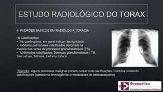 4- PADRÕES BÁSICOS EM RADIOLOGIA TORÁCIA
H) Calcificações:
• No parênquima, em geral indicam benignidade.
• Nódulos pulmonares calcificados decorrem na
maioria das vezes de processos granulomatosos (TB).
• Linfonodos calcificados: Doenças granulomatosas / TB,
Sarcoidose, Silicose, Linfoma tratado.
*Atenção: alguns processos malignos podem cursar com calcificações / nódulos contendo
calcificações (carcinoma broncogênico e metástases de osteossarcoma)
 
