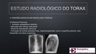 4- PADRÕES BÁSICOS EM RADIOLOGIA TORÁCIA
I) Enfisema Pulmonar:
• Achados radiográficos (tardios):
- Atenução das marcas vasculares
- Sinais de hipertensão pulmonar
- Formação de bolhas (paredes finas, hipertransparentes, junto a superfície pleural, mais
frequentes nos lobos superiores.
 