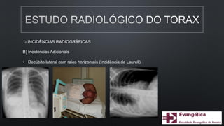1- INCIDÊNCIAS RADIOGRÁFICAS
B) Incidências Adicionais
• Decúbito lateral com raios horizontais (Incidência de Laurell)
 