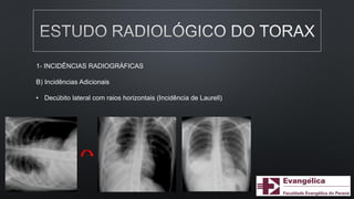 1- INCIDÊNCIAS RADIOGRÁFICAS
B) Incidências Adicionais
• Decúbito lateral com raios horizontais (Incidência de Laurell)
 