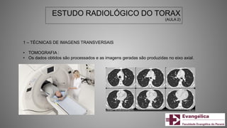 ESTUDO RADIOLÓGICO DO TORAX
(AULA 2)
1 – TÉCNICAS DE IMAGENS TRANSVERSAIS
• TOMOGRAFIA :
• Os dados obtidos são processados e as imagens geradas são produzidas no eixo axial.
 