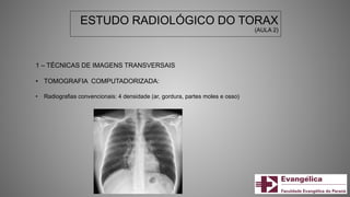 ESTUDO RADIOLÓGICO DO TORAX
(AULA 2)
1 – TÉCNICAS DE IMAGENS TRANSVERSAIS
• TOMOGRAFIA COMPUTADORIZADA:
• Radiografias convencionais: 4 densidade (ar, gordura, partes moles e osso)
 