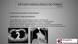 ESTUDO RADIOLÓGICO DO TORAX
(AULA 2)
1 – TÉCNICAS DE IMAGENS TRANSVERSAIS
• TOMOGRAFIA COMPUTADORIZADA:
• TC por utilizar raios-x, por convenção as imagens sintetizadas são:
• Pulmão normal: preto (porque o pulmão é radioluscente / radiotransparente).
• Osso: branco (porque absorve mais radiação é radiodenso / radiopaco)
• Músculo / água / gordura: progressivamente tons mais escuros de cinza (porque absorvem
progressivamente menos radiação / melhor contraste para distinguir músculo, líquido e gordura).
 