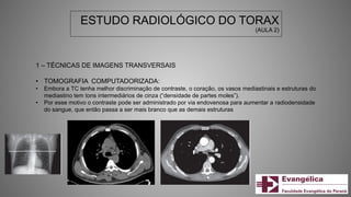 ESTUDO RADIOLÓGICO DO TORAX
(AULA 2)
1 – TÉCNICAS DE IMAGENS TRANSVERSAIS
• TOMOGRAFIA COMPUTADORIZADA:
• Embora a TC tenha melhor discriminação de contraste, o coração, os vasos mediastinais e estruturas do
mediastino tem tons intermediários de cinza (“densidade de partes moles”).
• Por esse motivo o contraste pode ser administrado por via endovenosa para aumentar a radiodensidade
do sangue, que então passa a ser mais branco que as demais estruturas
 