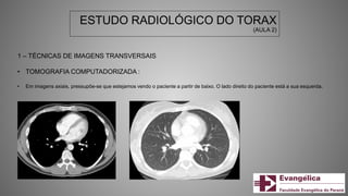ESTUDO RADIOLÓGICO DO TORAX
(AULA 2)
1 – TÉCNICAS DE IMAGENS TRANSVERSAIS
• TOMOGRAFIA COMPUTADORIZADA :
• Em imagens axiais, pressupõe-se que estejamos vendo o paciente a partir de baixo. O lado direito do paciente está a sua esquerda.
 