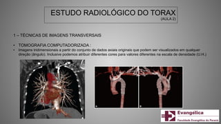 ESTUDO RADIOLÓGICO DO TORAX
(AULA 2)
1 – TÉCNICAS DE IMAGENS TRANSVERSAIS
• TOMOGRAFIA COMPUTADORIZADA :
• Imagens tridimensionais a partir do conjunto de dados axiais originais que podem ser visualizados em qualquer
direção (ângulo). Inclusive podemos atribuir diferentes cores para valores diferentes na escala de densidade (U.H.)
 