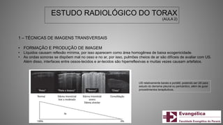 ESTUDO RADIOLÓGICO DO TORAX
(AULA 2)
1 – TÉCNICAS DE IMAGENS TRANSVERSAIS
• FORMAÇÃO E PRODUÇÃO DE IMAGEM
• Líquidos causam reflexão mínima, por isso aparecem como área homogênea de baixa ecogenicidade.
• As ondas sonoras se dispõem mal no osso e no ar, por isso, pulmões cheios de ar são difíceis de avaliar com US.
Além disso, interfaces entre ossos-tecidos e ar-tecidos são hiperreflexivas e muitas vezes causam artefatos.
US relativamente barato e portátil, podendo ser útil para
estudo do derrame pleural ou pericárdico, além de guiar
procedimentos terapêuticos.
 
