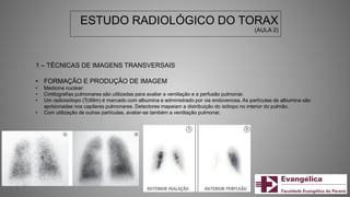 ESTUDO RADIOLÓGICO DO TORAX
(AULA 2)
1 – TÉCNICAS DE IMAGENS TRANSVERSAIS
• FORMAÇÃO E PRODUÇÃO DE IMAGEM
• Medicina nuclear:
• Cintilografias pulmonares são utilizadas para avaliar a ventilação e a perfusão pulmonar.
• Um radioisótopo (Tc99m) é marcado com albumina e administrado por via endovenosa. As partículas de albumina são
aprisionadas nos capilares pulmonares. Detectores mapeiam a distribuição do isótopo no interior do pulmão.
• Com utilização de outras partículas, avaliar-se também a ventilação pulmonar.
 