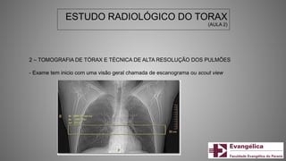 ESTUDO RADIOLÓGICO DO TORAX
(AULA 2)
2 – TOMOGRAFIA DE TÓRAX E TÉCNICA DE ALTA RESOLUÇÃO DOS PULMÕES
- Exame tem inicio com uma visão geral chamada de escanograma ou scout view
 
