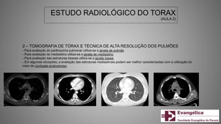 ESTUDO RADIOLÓGICO DO TORAX
(AULA 2)
2 – TOMOGRAFIA DE TÓRAX E TÉCNICA DE ALTA RESOLUÇÃO DOS PULMÕES
- Para avaliação do parênquima pulmonar utiliza-se a janela de pulmão
- Para avaliação do mediastino utiliza-se a janela de mediastino
- Para avaliação das estruturas ósseas utiliza-se a janela óssea.
- Em algumas situações, a avaliação das estruturas mediastinais podem ser melhor caracterizadas com a utilização do
meio de contraste endovenoso.
 
