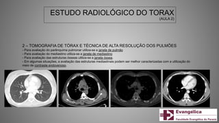 ESTUDO RADIOLÓGICO DO TORAX
(AULA 2)
2 – TOMOGRAFIA DE TÓRAX E TÉCNICA DE ALTA RESOLUÇÃO DOS PULMÕES
- Para avaliação do parênquima pulmonar utiliza-se a janela de pulmão
- Para avaliação do mediastino utiliza-se a janela de mediastino
- Para avaliação das estruturas ósseas utiliza-se a janela óssea.
- Em algumas situações, a avaliação das estruturas mediastinais podem ser melhor caracterizadas com a utilização do
meio de contraste endovenoso.
 