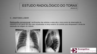 ESTUDO RADIOLÓGICO DO TORAX
(AULA 2)
3 – ANATOMIA LOBAR
Radiografia convencional: ramificações das artérias e veias são o único ponto de observação do
interstício e em geral não são mais visualizadas no terço externo do pulmão pois ultrapassam o limite da
resolução de imagem do método.
 