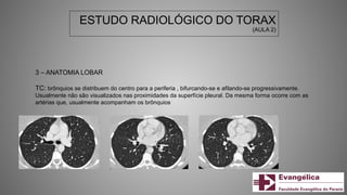 ESTUDO RADIOLÓGICO DO TORAX
(AULA 2)
3 – ANATOMIA LOBAR
TC: brônquios se distribuem do centro para a periferia , bifurcando-se e afilando-se progressivamente.
Usualmente não são visualizados nas proximidades da superfície pleural. Da mesma forma ocorre com as
artérias que, usualmente acompanham os brônquios
 