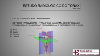 ESTUDO RADIOLÓGICO DO TORAX
(AULA 2)
1 – TÉCNICAS DE IMAGENS TRANSVERSAIS
• MÉTODOS TRANSVERSAIS – “FATIAS” QUE ELIMINAM A SOBREPOSIÇÃO E
POSSIBILITAM A VISUALIZAÇÃO TRIDIMENSIONAL E EM DIFERENTES PLANOS.
a) Axial
b) Sagital
c) Coronal
d) Oblíqua
 