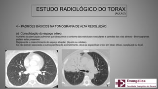 ESTUDO RADIOLÓGICO DO TORAX
(AULA 2)
4 – PADRÕES BÁSICOS NA TOMOGRAFIA DE ALTA RESOLUÇÃO:
a) Consolidação do espaço aéreo:
Aumento da atenuação pulmonar que obscurece o contorno das estruturas vasculares e paredes das vias aéreas – Broncogramas
podem estar presentes
Representa o preenchimento do espaço alveolar (liquido ou células).
Se não estiver associada a outros padrões de acometimento, deve-se especificar o tipo em lobar, difuso, subpleural ou focal.
 