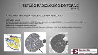 ESTUDO RADIOLÓGICO DO TORAX
(AULA 2)
4 – PADRÕES BÁSICOS NA TOMOGRAFIA DE ALTA RESOLUÇÃO:
c) Padrão septal
Resulta do espessamento de septos interlobulares, que aparecem como opacidades lineares, que se estendem por até 2 cm.
Na periferia: distribuição perpendicular a superfície pleural
Nas porções centrais foram imagens poligonais
Ocorre no edema pulmonar hidrostático, infiltração dos vasos linfáticos por tumor (linfangite) e condições inflamatórias.
 