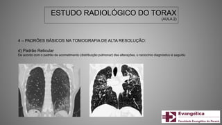 ESTUDO RADIOLÓGICO DO TORAX
(AULA 2)
4 – PADRÕES BÁSICOS NA TOMOGRAFIA DE ALTA RESOLUÇÃO:
d) Padrão Reticular
De acordo com o padrão de acometimento (distribuição pulmonar) das alterações, o raciocínio diagnóstico é seguido
 