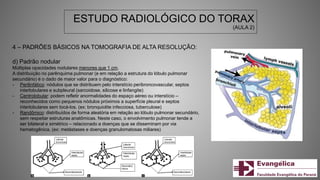 ESTUDO RADIOLÓGICO DO TORAX
(AULA 2)
4 – PADRÕES BÁSICOS NA TOMOGRAFIA DE ALTA RESOLUÇÃO:
d) Padrão nodular
Múltiplas opacidades nodulares menores que 1 cm.
A distribuição no parênquima pulmonar (e em relação a estrutura do lóbulo pulmonar
secundário) é o dado de maior valor para o diagnóstico:
- Perilinfático: nódulos que se distribuem pelo interstício peribroncovascular, septos
interlobulares e subpleural (sarcoidose, silicose e linfangite)
- Centrolobular: podem refletir anormalidades do espaço aéreo ou interstício –
reconhecidos como pequenos nódulos próximos a superfície pleural e septos
interlobulares sem tocá-los. (ex: bronquiolite infecciosa, tuberculose)
- Randômico: distribuídos de forma aleatória em relação ao lóbulo pulmonar secundário,
sem respeitar estruturas anatômicas. Neste caso, o envolvimento pulmonar tende a
ser bilateral e simétrico – relacionado a doenças que se disseminam por via
hematogênica. (ex: metástases e doenças granulomatosas miliares)
 