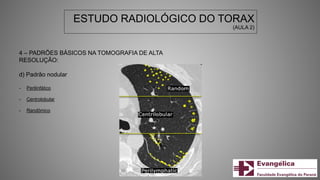 ESTUDO RADIOLÓGICO DO TORAX
(AULA 2)
4 – PADRÕES BÁSICOS NA TOMOGRAFIA DE ALTA
RESOLUÇÃO:
d) Padrão nodular
- Perilinfático
- Centrolobular
- Randômico
 