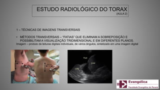 ESTUDO RADIOLÓGICO DO TORAX
(AULA 2)
1 – TÉCNICAS DE IMAGENS TRANSVERSAIS
• MÉTODOS TRANSVERSAIS – “FATIAS” QUE ELIMINAM A SOBREPOSIÇÃO E
POSSIBILITAM A VISUALIZAÇÃO TRIDIMENSIONAL E EM DIFERENTES PLANOS.
Imagem – produto de leituras digitais individuais, de vários ângulos, sintetizado em uma imagem digital
 