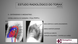 5 – ENTENDENDO O MEDIASTINO:
Llimites externos do mediastino (Tórax PERFIL)
ESTUDO RADIOLÓGICO DO TORAX
(AULA 2)
ARCO AÓRTICO E AORTA DESCENDENTE
JANELA AORTOPULMONAR
VENTRÍCULO DIREITO
CORAÇÃO ESQUERDO – VENTRÍCULO E ATRIO
 