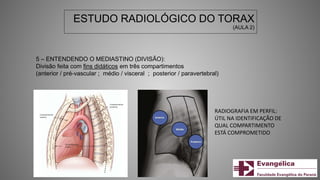 ESTUDO RADIOLÓGICO DO TORAX
(AULA 2)
5 – ENTENDENDO O MEDIASTINO (DIVISÃO):
Divisão feita com fins didáticos em três compartimentos
(anterior / pré-vascular ; médio / visceral ; posterior / paravertebral)
RADIOGRAFIA EM PERFIL:
ÚTIL NA IDENTIFICAÇÃO DE
QUAL COMPARTIMENTO
ESTÁ COMPROMETIDO
 