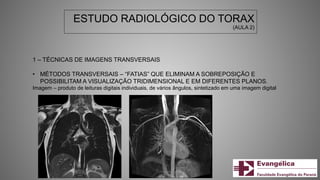 ESTUDO RADIOLÓGICO DO TORAX
(AULA 2)
1 – TÉCNICAS DE IMAGENS TRANSVERSAIS
• MÉTODOS TRANSVERSAIS – “FATIAS” QUE ELIMINAM A SOBREPOSIÇÃO E
POSSIBILITAM A VISUALIZAÇÃO TRIDIMENSIONAL E EM DIFERENTES PLANOS.
Imagem – produto de leituras digitais individuais, de vários ângulos, sintetizado em uma imagem digital
 