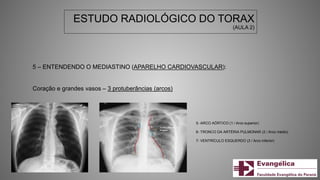 ESTUDO RADIOLÓGICO DO TORAX
(AULA 2)
5 – ENTENDENDO O MEDIASTINO (APARELHO CARDIOVASCULAR):
Coração e grandes vasos – 3 protuberâncias (arcos)
5- ARCO AÓRTICO (1 / Arco superior)
6- TRONCO DA ARTÉRIA PULMONAR (2 / Arco médio)
7- VENTRÍCULO ESQUERDO (3 / Arco inferior)
 