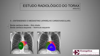 ESTUDO RADIOLÓGICO DO TORAX
(AULA 2)
5 – ENTENDENDO O MEDIASTINO (APARELHO CARDIOVASCULAR):
Borda cardíaca direita – Átrio direito
Borda cardíaca esquerda – Ventrículo esquerdo
 