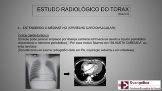 ESTUDO RADIOLÓGICO DO TORAX
(AULA 2)
5 – ENTENDENDO O MEDIASTINO (APARELHO CARDIOVASCULAR):
Índice cardiotorácico
Coração pode parecer ampliado por doença cardíaca intrínseca ou devido a líquido pericárdico
circundando-o (derrame pericárdico) – Por esse motivo falamos em “SILHUETA CARDÍACA” ou
área cardíaca.
(Considerando-se exame radiográfico feito em PA, inspiração máxima e em ortostase)
 