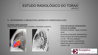 ESTUDO RADIOLÓGICO DO TORAX
(AULA 2)
5 – ENTENDENDO O MEDIASTINO (APARELHO CARDIOVASCULAR):
Aumento atrial esquerdo
(Doença Valvar mitral de origem reumática / cardiopatias congênitas)
- Sinal mais precoce: deslocamento
posterior do esôfago
- Aumento à direita : duplo contorno
atrial
- Aumento à esquerda: abaulamento
entre o tronco da artéria pulmonar
e o VE – “4º arco cardíaco”
- Aumento superior: aumento do
ângulo da carina traqueal (>90°) -
normal = 60°
 