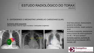 ESTUDO RADIOLÓGICO DO TORAX
(AULA 2)
5 – ENTENDENDO O MEDIASTINO (APARELHO CARDIOVASCULAR):
Aumento atrial esquerdo
(Doença Valvar mitral de origem reumática / cardiopatias congênitas)
- Sinal mais precoce: deslocamento
posterior do esôfago
- Aumento à direita : duplo contorno
atrial
- Aumento à esquerda: abaulamento
entre o tronco da artéria pulmonar
e o VE – “4º arco cardíaco”
- Aumento superior: aumento do
ângulo da carina traqueal (>90°) -
normal = 60°
 