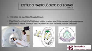 ESTUDO RADIOLÓGICO DO TORAX
(AULA 2)
1 – TÉCNICAS DE IMAGENS TRANSVERSAIS
• TOMOGRAFIA COMPUTADORIZADA: obtidas no plano axial. Feixe de raios-x atinge pequenos
detectores na parede oposta ao gantry e passam em uma varredura contínua (helicoidal).
 