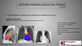 ESTUDO RADIOLÓGICO DO TORAX
(AULA 2)
5 – ENTENDENDO O MEDIASTINO (APARELHO CARDIOVASCULAR):
Aumento atrial direito
(Defeitos do septo atrial / estenose e insuficiência tricúspide / Insuf VE)
- Difícil avaliação na radiografia
mesmo quando bastante
aumentada.
- Afasta a borda cardíaca para mais à
direita da coluna.
- Pode alterar o ângulo cardiofrênico
direito
 