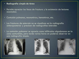 Torax Inestable Rx Torax inestable | PPTX