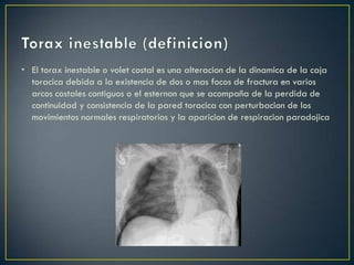 Torax Inestable Rx Torax inestable | PPTX