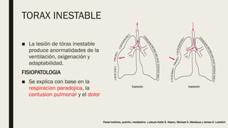 Torax Inestable Rx Torax inestable manejo y tratamiento .pptx