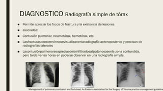 Torax Inestable Rx Torax inestable manejo y tratamiento .pptx