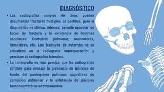 Tórax Inestable | PDF