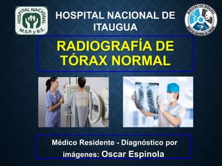 RADIOGRAFÍA DE
TÓRAX NORMAL
Médico Residente - Diagnóstico por
imágenes: Oscar Espinola
HOSPITAL NACIONAL DE
ITAUGUA
 