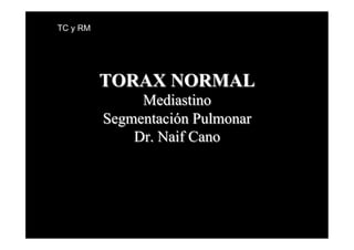 TC y RM




          TORAX NORMAL
               Mediastino
          Segmentación Pulmonar
              Dr. Naif Cano
 
