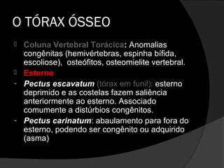 O TÓRAX ÓSSEO
 Coluna Vertebral Torácica: Anomalias
  congênitas (hemivértebras, espinha bífida,
  escoliose), osteófitos, osteomielite vertebral.
 Esterno
- Pectus escavatum (tórax em funil): esterno
  deprimido e as costelas fazem saliência
  anteriormente ao esterno. Associado
  comumente a distúrbios congênitos.
- Pectus carinatum: abaulamento para fora do
  esterno, podendo ser congênito ou adquirido
  (asma)
 