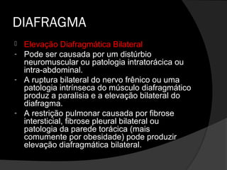 DIAFRAGMA
 Elevação Diafragmática Bilateral
- Pode ser causada por um distúrbio
  neuromuscular ou patologia intratorácica ou
  intra-abdominal.
- A ruptura bilateral do nervo frênico ou uma
  patologia intrínseca do músculo diafragmático
  produz a paralisia e a elevação bilateral do
  diafragma.
- A restrição pulmonar causada por fibrose
  intersticial, fibrose pleural bilateral ou
  patologia da parede torácica (mais
  comumente por obesidade) pode produzir
  elevação diafragmática bilateral.
 