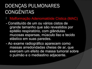 DOENÇAS PULMONARES
CONGÊNITAS
  Malformação Adenomatóide Cística (MAC)
- Constituído de um ou vários cistos de
   grande tamanho que são revestidos por
   epitélio respiratório, com glândulas
   mucosas esparsas, músculo liso e tecido
   elástico em suas paredes.
- Ao exame radiográfico aparecem como
   massas arredondadas cheias de ar, que
   exercem um efeito de massa tumoral sobre
   o pulmão e o mediastino adjacente.
 