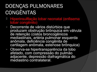 DOENÇAS PULMONARES
CONGÊNITAS
   Hiperinsulflação lobar neonatal (enfisema
    lobar congênito)
-   Decorrente de vários distúrbios que
    produzam obstrução brônquica em válvula
    de retenção (cistos broncogênicos
    mediastinais, artéria pulmonar esquerda
    anômala, deficiência congênita de
    cartilagem anômala, estenose brônquica)
-   Observa-se hipertransparência da lobo
    afetado, com compressão do pulmão
    adjacente, depressão diafragmática do
    mediastino contralateral.
 