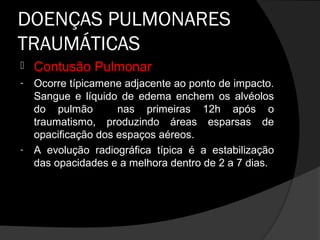 DOENÇAS PULMONARES
TRAUMÁTICAS
   Contusão Pulmonar
-   Ocorre típicamene adjacente ao ponto de impacto.
    Sangue e líquido de edema enchem os alvéolos
    do pulmão        nas primeiras 12h após o
    traumatismo, produzindo áreas esparsas de
    opacificação dos espaços aéreos.
-   A evolução radiográfica típica é a estabilização
    das opacidades e a melhora dentro de 2 a 7 dias.
 