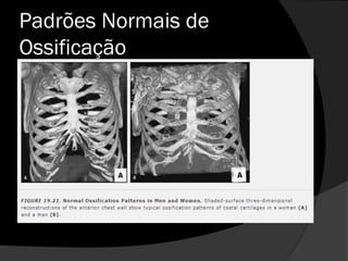 Padrões Normais de
Ossificação
 