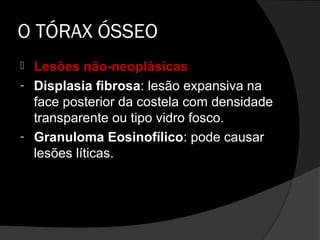 O TÓRAX ÓSSEO
 Lesões não-neoplásicas
- Displasia fibrosa: lesão expansiva na
  face posterior da costela com densidade
  transparente ou tipo vidro fosco.
- Granuloma Eosinofílico: pode causar
  lesões líticas.
 